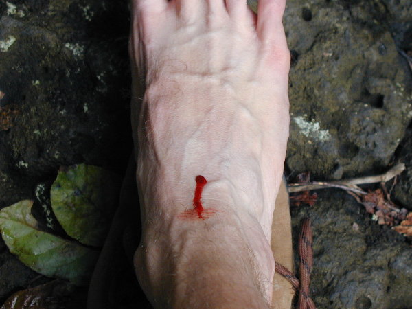 http://www.danciprari.com/images/worldtrip/australia/small/au-woo-rainforest-nandroya-hike-leach-blood-600.jpg